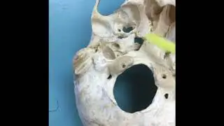 Foramen Of The Cranial Base