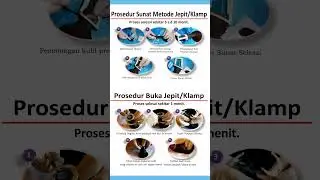 Metode Sunat Klamp Atau Jepit