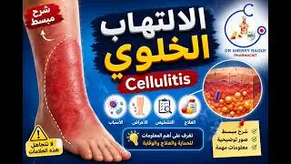 CELLULITIS skin infection  صيدلة اكلينيكية - كورس infectious diseases