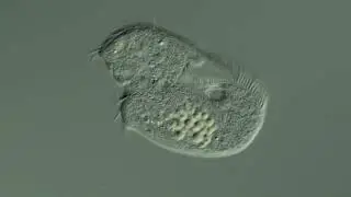 damaged protozoa, আণুবীক্ষণিক / microscopic creatures created by ALLAH, THE ONLY CREATOR
