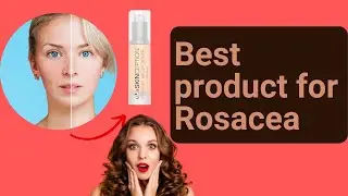 Skinception Don't buy without seeing this video - Skinception review