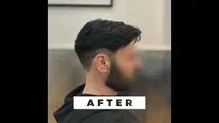 Private and Friends - Centri Infoltimento Capelli