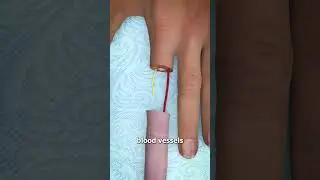 Можно ли пришить обратно оторванный палец? 🤔