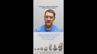 Can you Pass a Kidney Stone on Your Own?