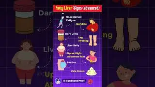 10 Warning Signs of Fatty Liver You Should Never Ignore! Fatty Liver Disease
