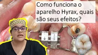 Como saber se o Hyrax está funcionando?| Dra Bianca Rosa