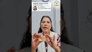 Loose Dentures Solution is Overdentures.  #dentalclinic #dentist #loosedentures #overdentures