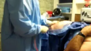 Liposuction-Smartlipo-Huntington Beach-Irvine-Cosa Mesa-Santa Ana-fountain Valley-Garden Grove