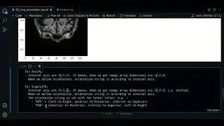 1.1 - MRI image orientation with SimpleITK - Course MRI preprocessing with Python