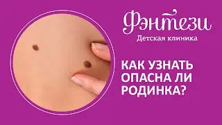 Как узнать опасна ли родинка❓🤔