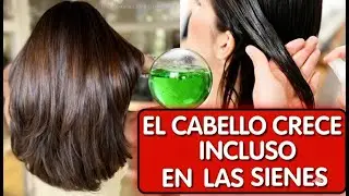 MEZCLA ESTO EN TU SHAMPOO Y TU CABELLO NO PARAR&Aacute; DE CRECER (REMEDIO POTENTE)