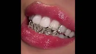 Teeth gems 