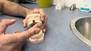 What Can Be Done For A Missing Front Tooth