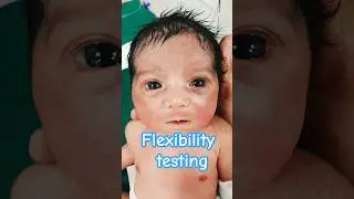 Newborn rooting reflex test/rooting flexibility #newbornbaby #youtubeshorts #trendingshorts #cute