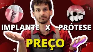 O que é mais caro implante ou prótese?