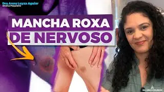 Ansiedade e Estresse causam MANCHA ROXA NO CORPO? | Dra. Anna Luyza Aguiar