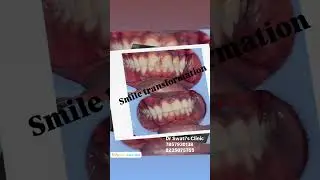 &ldquo;Precision Dentistry. Predictable Results | Real Patient Smile Transformation&rdquo;.