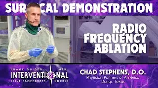 Radiofrequency Ablation - Chad Stephens, D.O.