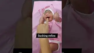 Sucking reflex in New born #newborn #baby #ytshorts
