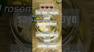 Amazing home remedy for varicose and spider veins. #remedy #health #naturalrecipe #naturalbeauty
