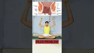 If you're suffering from piles, try this #piles #health #yoga #shortvideo #shorts #ytshorts #forword