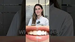 3 Dentist-Approved Hacks for White Teeth