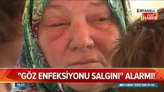 Göz enfeksiyonu salgınına dikkat - Atv Haber 3 Temmuz 2018