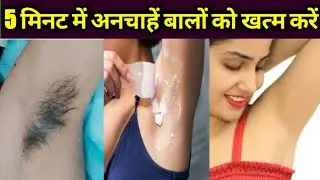 अपने अनचाहे बालों को कैसे खत्म करें || best laboliya hair remove cream,remove cream