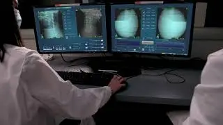 CyberKnife Explained