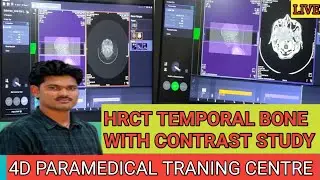 HOW TO SCAN HRCT TEMPORAL BONE WITH CONTRAST STUDY. #viralvideo #ctscan #radiology #hemantkushwah