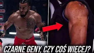 &bdquo;Czarne Geny&rdquo; Czy Coś Więcej? | Alberto Simao