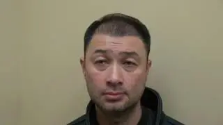 Hair Transplant 3rd Month Follow Up Surgery Progress Dr. Diep http://www.mhtaclinic.com