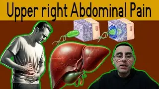 Top 7 Causes of Upper Right Abdominal Pain