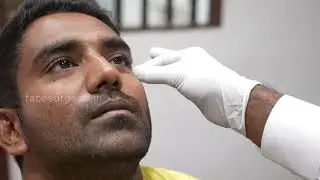 Accident Scar Removal Consultation