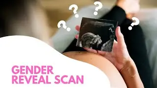 👶 Gender Reveal Scan 🤍 | Finding Out Baby&rsquo;s Gender! 💙💖