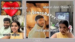 Seeing Our Baby in 3D | Anomaly Scan Vlog | Marathi vlogs | Swati Thorat Vlogs