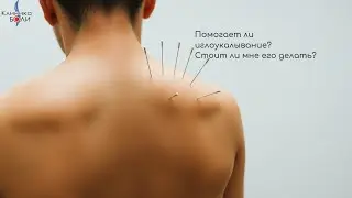 Помогает ли иглоукалывание? Стоит ли мне его делать? 