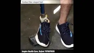 Carbon Fiber Foot Movements