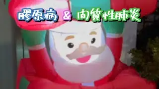 間質性肺炎