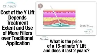 Cost Factors of the Y Lift&reg; - Cosmetic Fillers on Bone Structure for Better Volume Enhancement