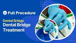 Dental Bridge Procedure | Dental Bridge Treatment | How to Apply Dental Bridge