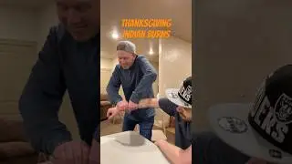 Thanksgiving Day Indian Burns! Funny! #funny #funnyshorts #funnyvideo