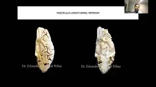 Clase 4 Anatomía de fibras blancas