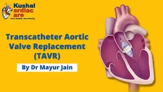 DR. MAYUR JAIN | INTERVENTIONAL CARDIOLOGIST IN THANE | KUSHAL CARDIAC CARE | TAVI | TAVR
