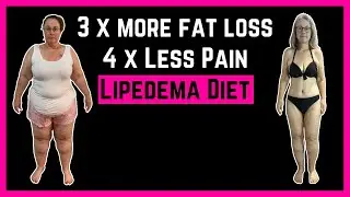 Eating to Halt Lipedema in 2026