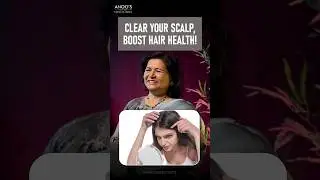 Oily Scalp, Greasy Roots & Dandruff? Fix the Real Cause  #oilyscalp #dandruff #anoos
