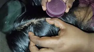 #asmr scalp checking and killing lice and nits 🥵