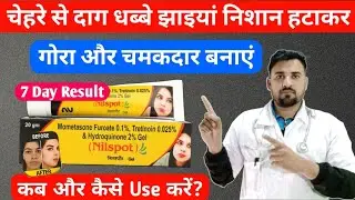 सस्ती क्रीम जो देती है खूबसूरत गोरापन | Skin Whitening Cream | Nilspot Gel Review 2025