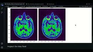 3.1 - Bias Field visualization | SimpleITK - Course MRI preprocessing with Python