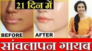 Easy home remedy to get fair face | Dr Upasana Vohra | Gora hone ka tarika | Way to get fair skin